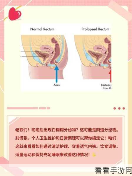 太华伽罗躺床上流白色分泌物：太华伽罗躺床上流白色分泌物的原因与处理方法分析